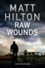 Raw_wounds